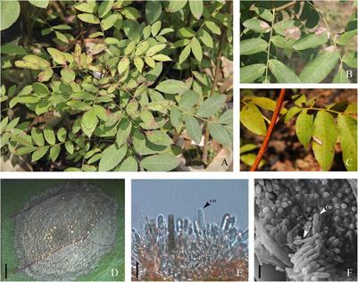 Etiology of Cyclocarya paliurus Anthracnose in Jiangsu Province, China